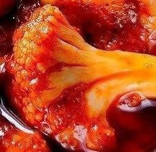 Mango Pickle